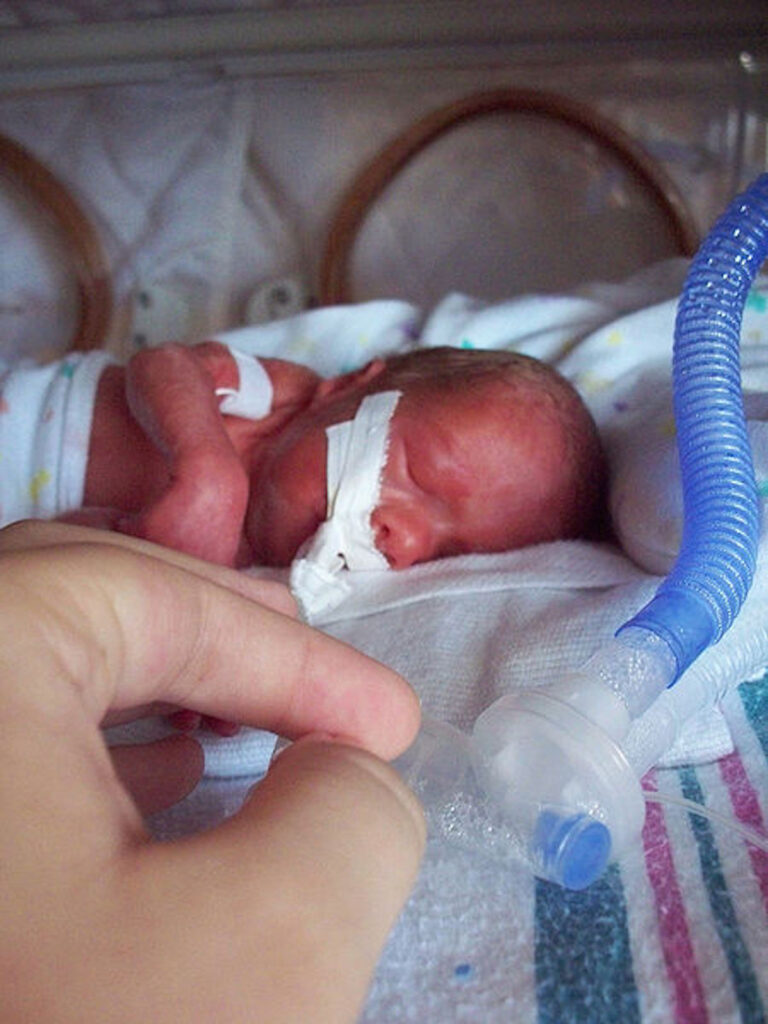 Una mostra fotografica per la Giornata internazionale del neonato pretermine