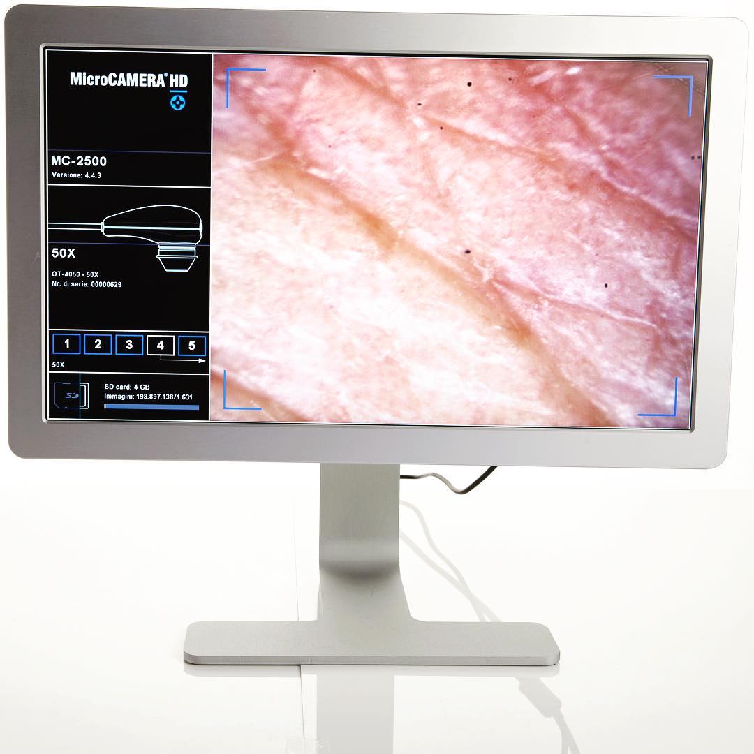 videodermatoscopia