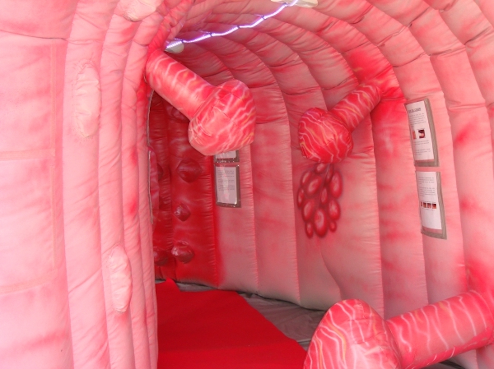 Colon Gonfiabile
