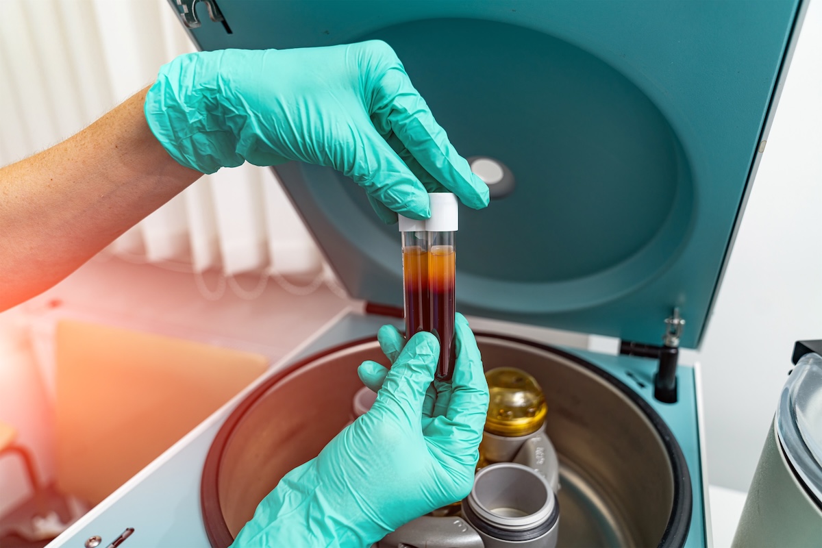 Infiltrazione di PRP - Premium medica