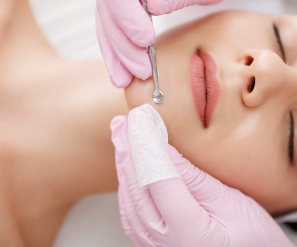 Young woman gets facial cleansing in a cosmetologist's office Skin cleaning at beauty salon Beautician squeezing pimples and blackheads from face - punti neri