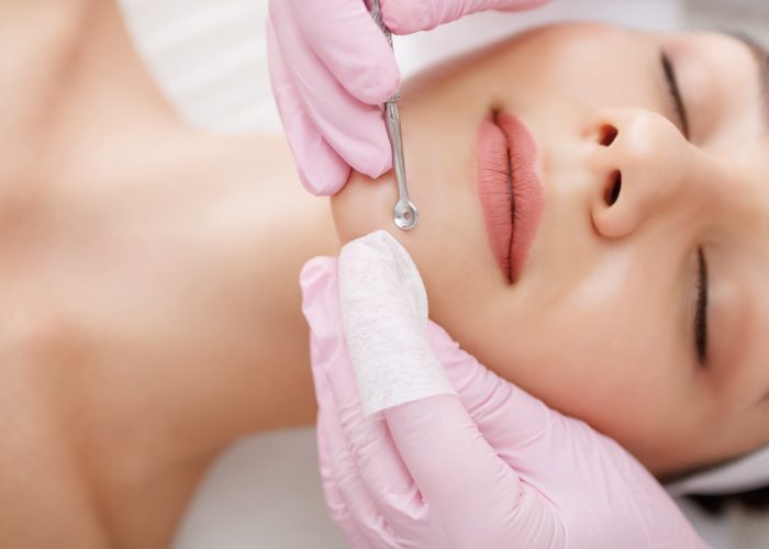 Young woman gets facial cleansing in a cosmetologist's office Skin cleaning at beauty salon Beautician squeezing pimples and blackheads from face - punti neri