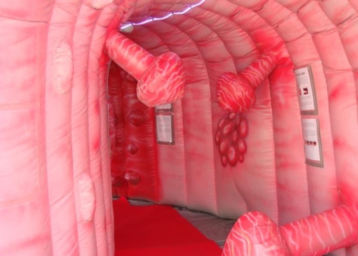 Colon Gonfiabile