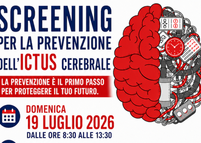 DOUES SCREENING Associazione Alice ictus cerebrali