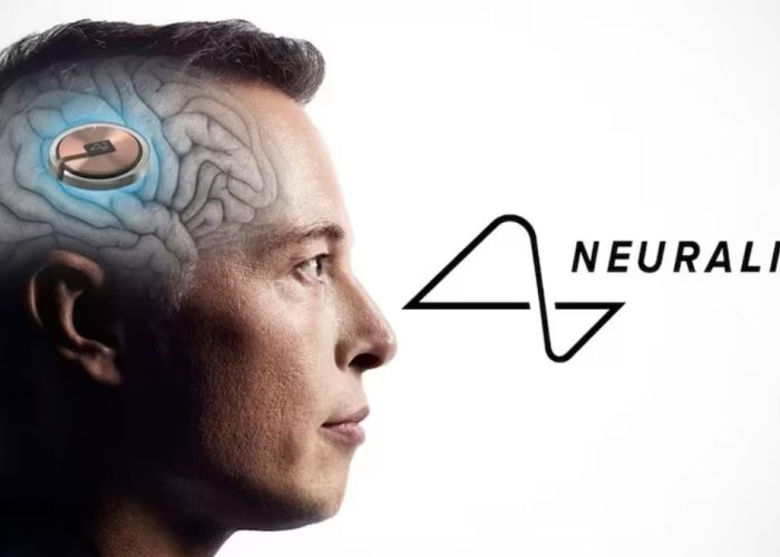 Neuralink