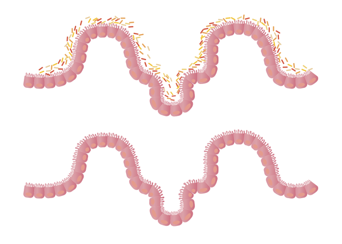 microbiota intestinale